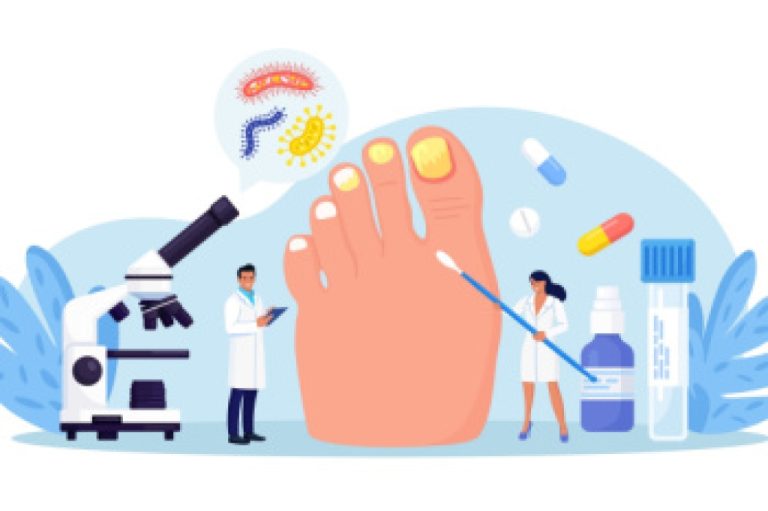 Symptoms and Risks of Toenail Fungus