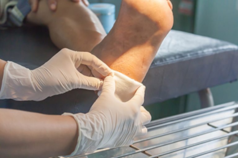 Wound Healing in Diabetic Patients