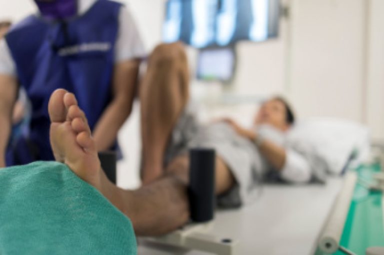When Repetitive Stress Leads to Tiny Foot Fractures